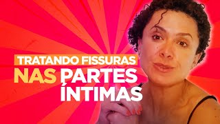 Como Tratar Fissuras Nas Partes Íntimas? Dra Patricia Bretz