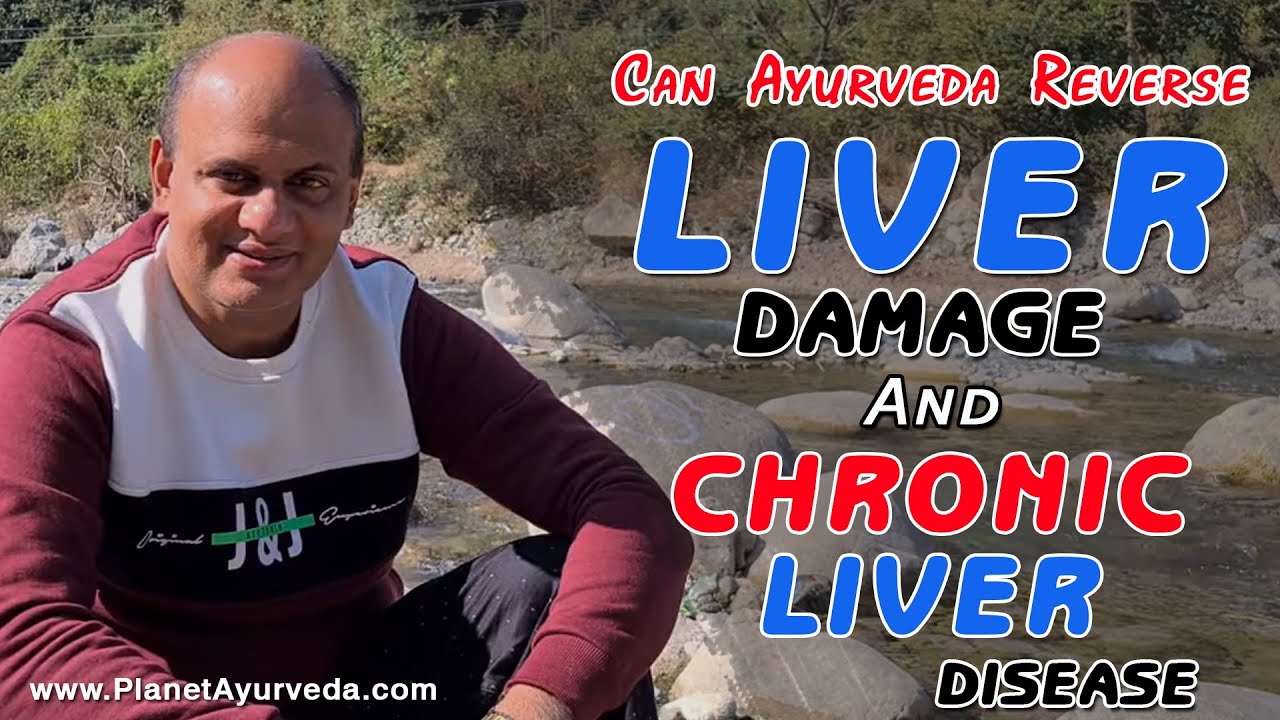 Watch Video Ayurvedic Cure of Chronic Liver Disease - Real Testimonials