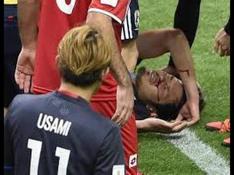 日本代表mf 山口蛍 負傷退場 鼻骨骨折および左眼窩底骨折と診断 Youtube