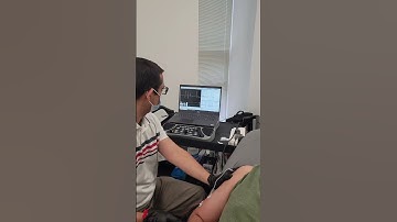 Needle EMG of Right Deltoid muscle!!!