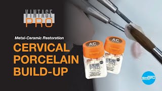 Metal-Ceramic Restoration – Cervical Porcelain Build-up