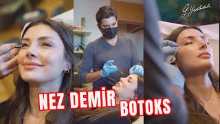 Nez Demire Botoks Uygulaması Yaptık I Op Dr Güray Yeşiladalı 