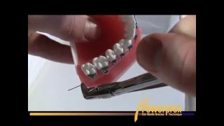 Cara menggunakan Distal end Cutter screenshot 4