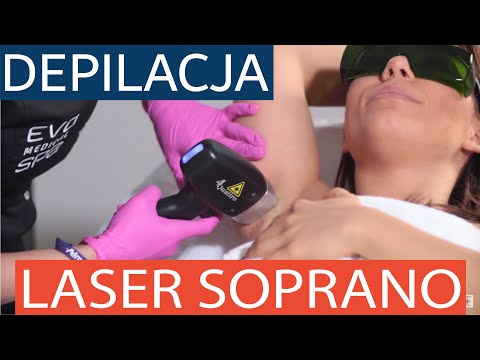 Wideo: Depilacja laserowa Soprano XL