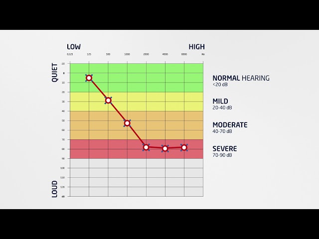How to read an Audiogram | hear.com