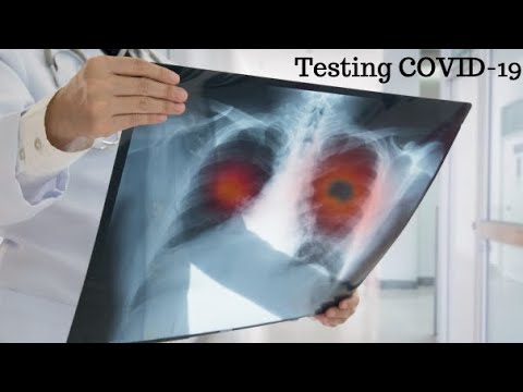 COVID-19 Chest X-RAY Detection using Deep Learning - Testing COVID-19 Part 6