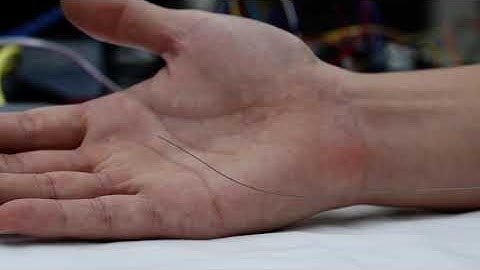 Demonstration of a Coaxially Aligned, Robotically Steerable Guidewire (8451)