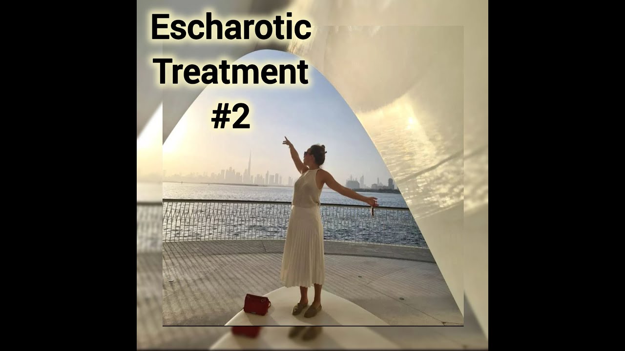 HPV: ESCHAROTIC TREATMENT#2: Suppositories, Healing and Shedding of the Cervix - CERVICAL DYSPLASIA