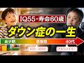 データで読み解く、ダウン症の過酷な運命