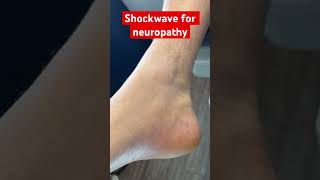 How I treat neuropathy with shockwave therapy screenshot 4