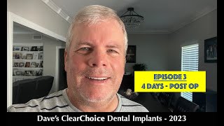 ClearChoice Dental Implants 2023 - 4 Days Post-Op (E3)