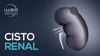 Cisto no Rim é perigoso ? Como eliminar Cisto renal ?