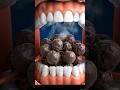 Muh sukh raha hai? Body aapko signal de rahi hai 🚨 #gutka #tobacco #drymouth #oralhealth #miuthcare