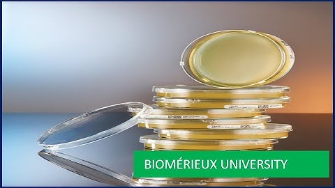 COUNT-TACT® 3P® Plates Systems: How Open Plate Packaging