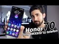 Sony IMX800&#39;lü kamerası şaşırtıcı ama alınır mı? “Honor 70 incelemesi”