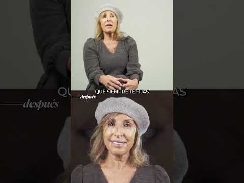 Su sonrisa volvió a funcionar