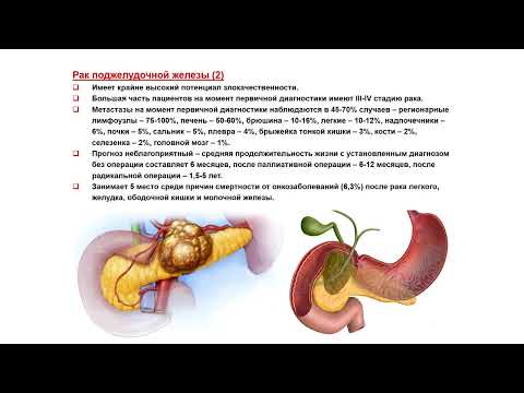 УЗИ. Доктор Иогансен. Выпуск 56. Злокачественные опухоли поджелудочной железы. Часть 1. УЗИ. Доктор Иогансен. Выпуск 56. Злокачественные опухоли поджелудочной железы. Часть 1.