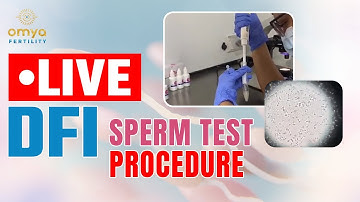 🔴Live DFI Test Procedure Step by Step | Sperm DNA Fragmentation Test | Omya Fertility | Delhi