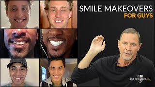 Smile Makeovers for Guys w/ No Cosmetic Dentist - Dental Veneers Designed by Brighter Image Lab