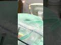 Грижа жарроҳлигида Замонавий Ёндашув — Эндоскопик Усул!