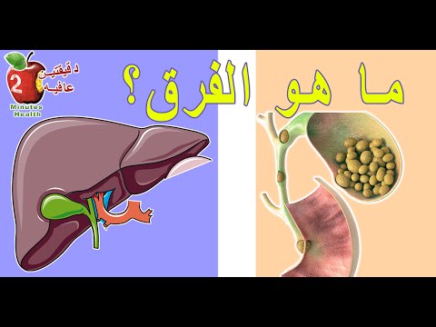 ألم  البطن | علامات الفرق بين الم المرارة و الم الكبد