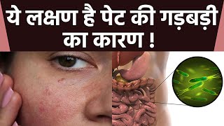 चेहरे पर लाल चकत्ते है पेट में गड़बड़ी का कारण | Pet Me Good Bacteria Kaise Badhaye | Boldsky Resimi