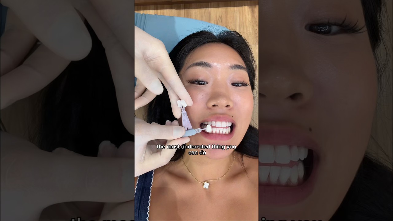 Teeth whitening in Korea🦷🤩 #korea #teethwhitening
