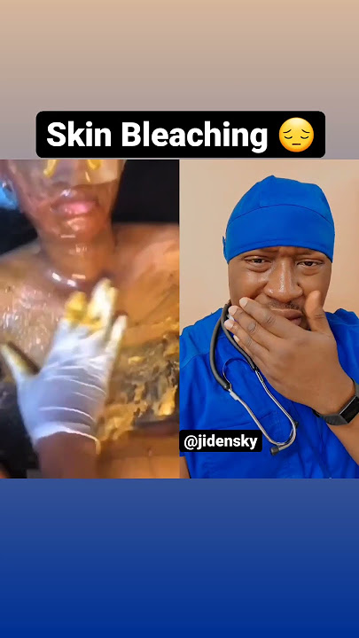 SKIN BLEACHING