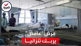 مرض غامض يظهر في تنزانيا ويُربك السلطات.. ما أعراضه؟