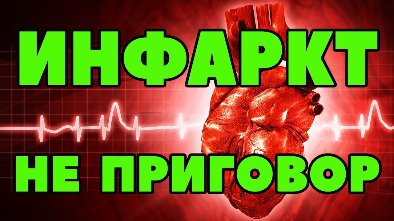 Как я вылечил инфаркт thumbnail