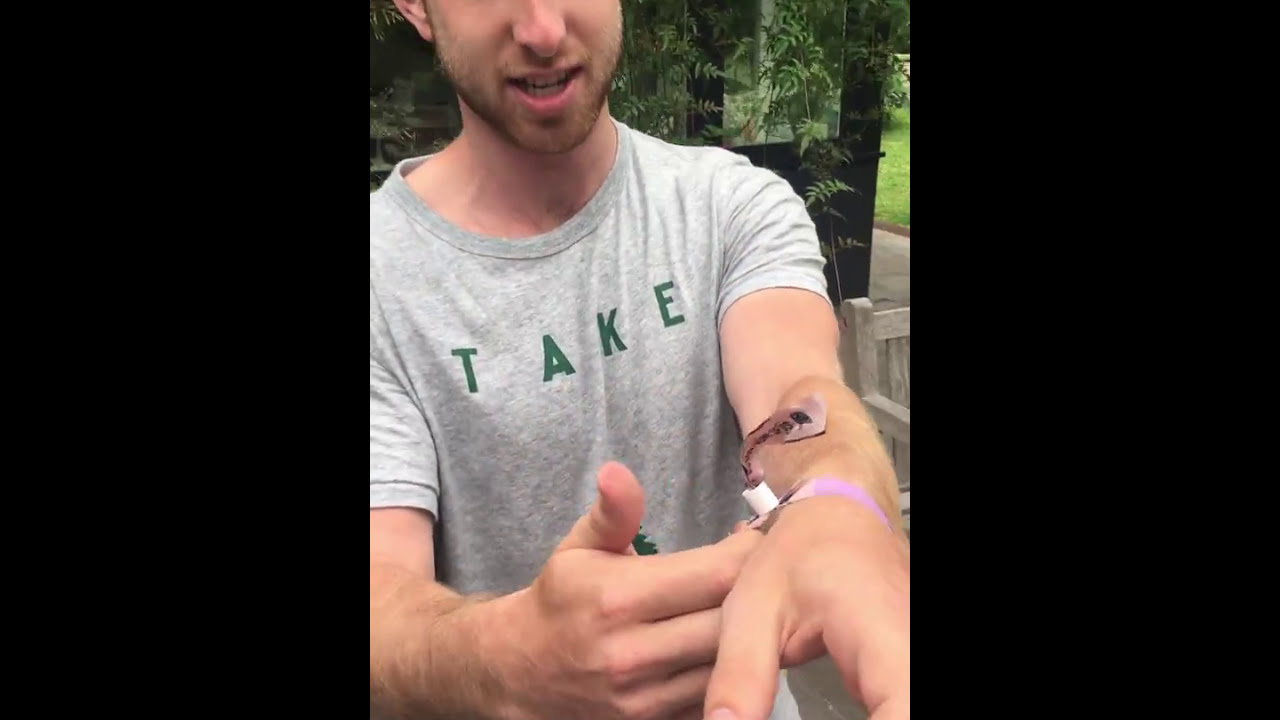 How to Take Off a Festival Wristband Part II