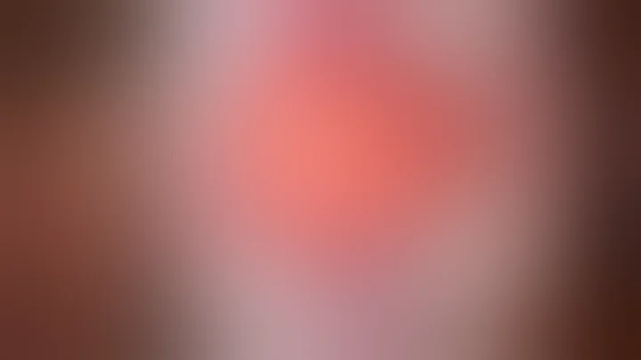 #evo  ICL in NEW YORK Surgeon to Beyond 20/20 Vision: GulaniVision!