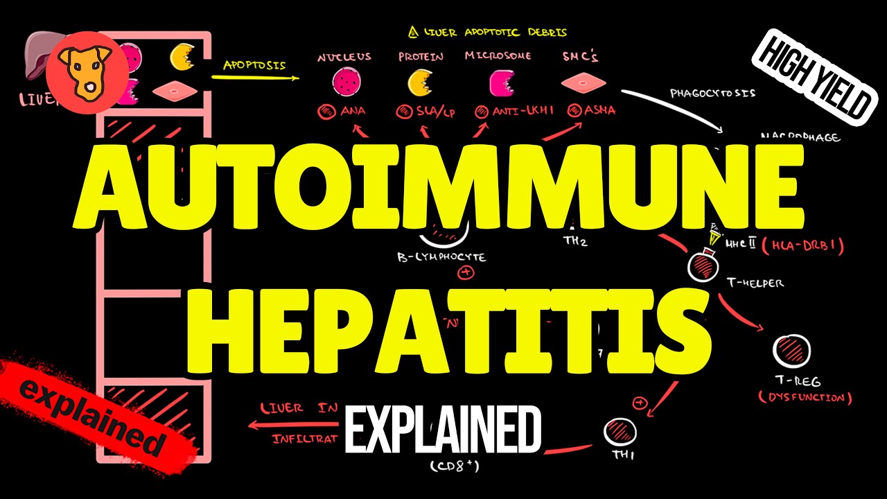 AUTOIMMUNE HEPATITIS Pathogenesis Clinical symptoms Diagnostic criteria Treatment YouTube
