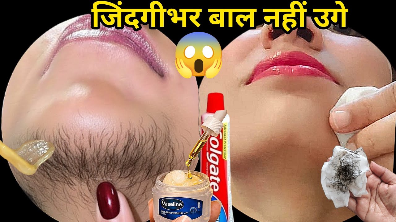 डॉक्टर ने बताया Vaseline से बिना दर्द चेहरे के बाल निकालने का आसान तरीका😱|| Facial Hair Removal