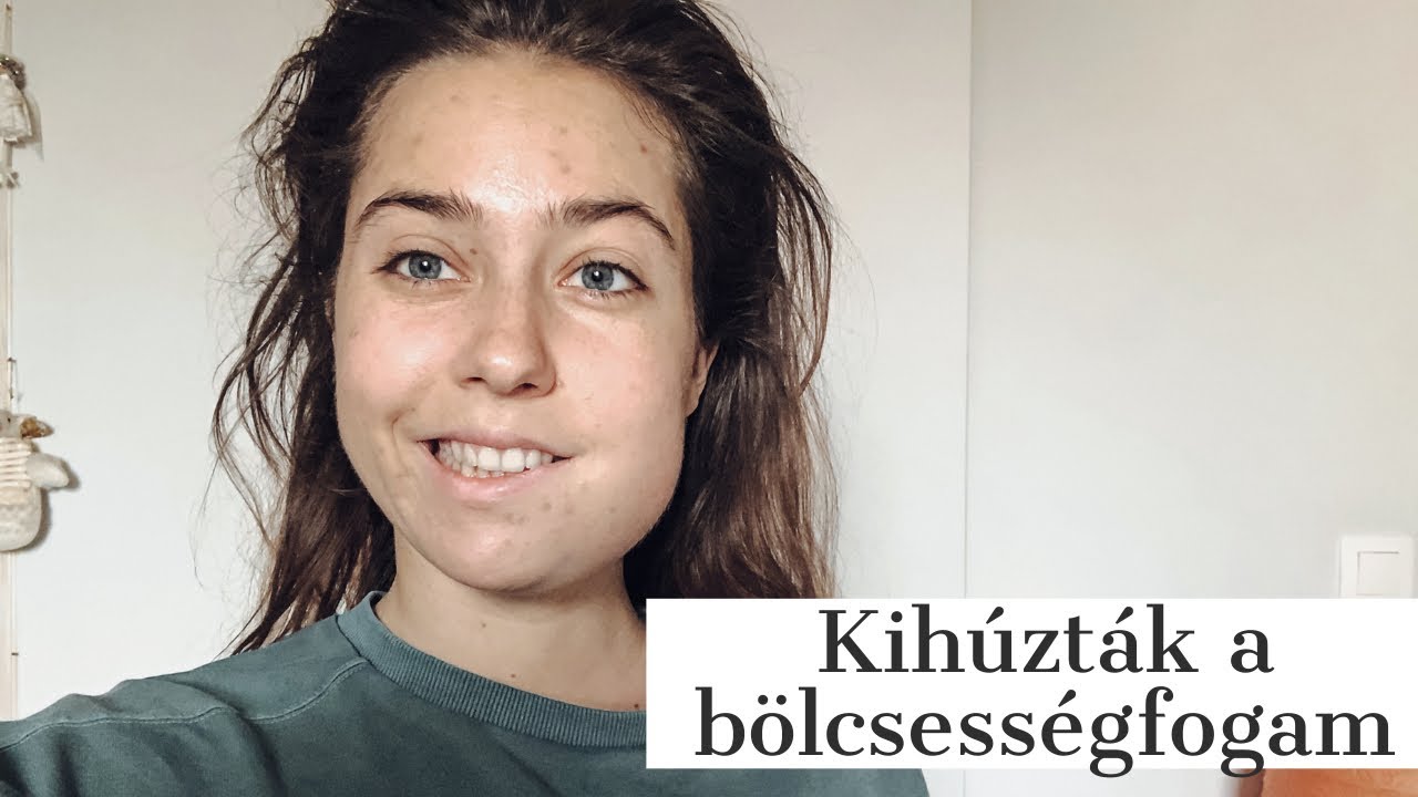 3x akkorára dagadt az arcom😱