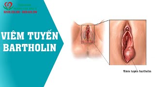 {Nguyên nhân & cách chữa}: Sưng 1 bên môi lớn môi bé