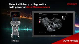 ViV 40 Powerful Auto Measurements