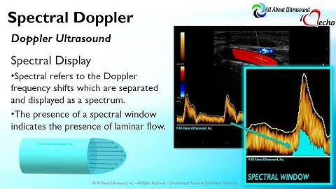 Doppler Principles: Spectral Doppler