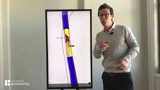 What is Pulmonary Embolism? - Dr. Tom Talks