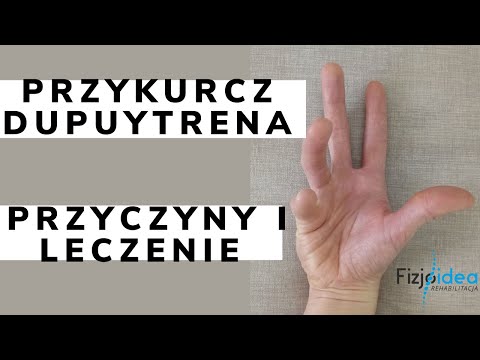 Wideo: Skurcze Dłoni I Palców - Przyczyny, Jak Leczyć?