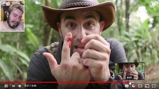 Ölümcül Böcek Isirma Ve Sokmalari