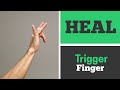 How to Heal Trigger Finger with 4 Exercises That Work! (Real Patient)