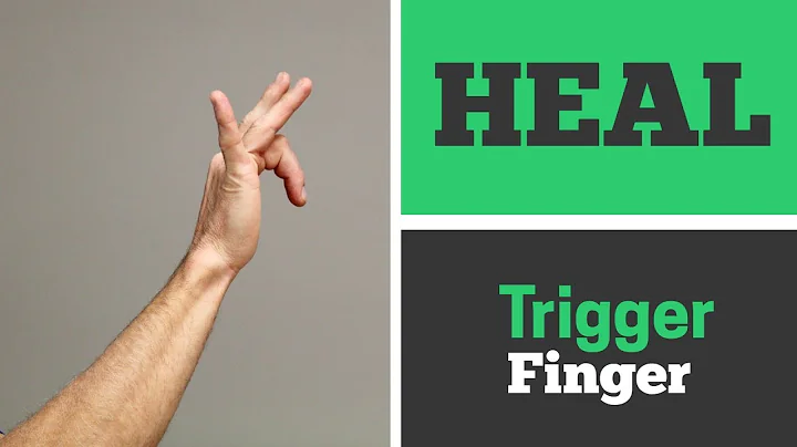 How to Heal Trigger Finger with 4 Exercises That Work! (Real Patient)