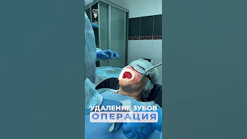 Удаление зубов. Не для слабонервных.