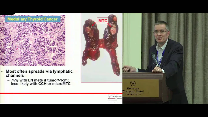 Thyroid Cancer in Children and Teens: Overview & I...