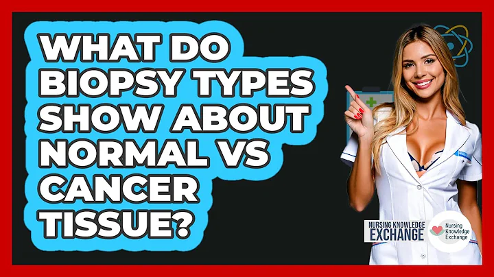 What Do Biopsy Types Show About Normal Vs Cancer Tissue? - Nursing Knowledge Exchange