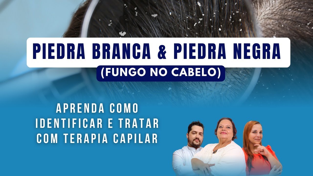 PIEDRA BRANCA & PIEDRA NEGRA [Fungo no Cabelo] Aprenda como Identificar e Tratar c/ Terapia Capilar.