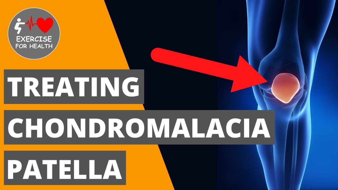 Exercises to treat runners’ knee (Patellofemoral Pain Syndrome)