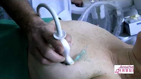 Come fare un controllo al seno?