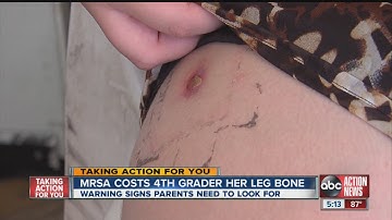 4th grader contracts MRSA